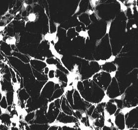 2-photon microscope image of neurons growing in vitro
